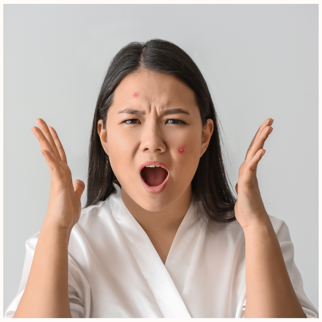 Naturally Clean Makeup for Acne-Prone Brides | Taylor Made Organics