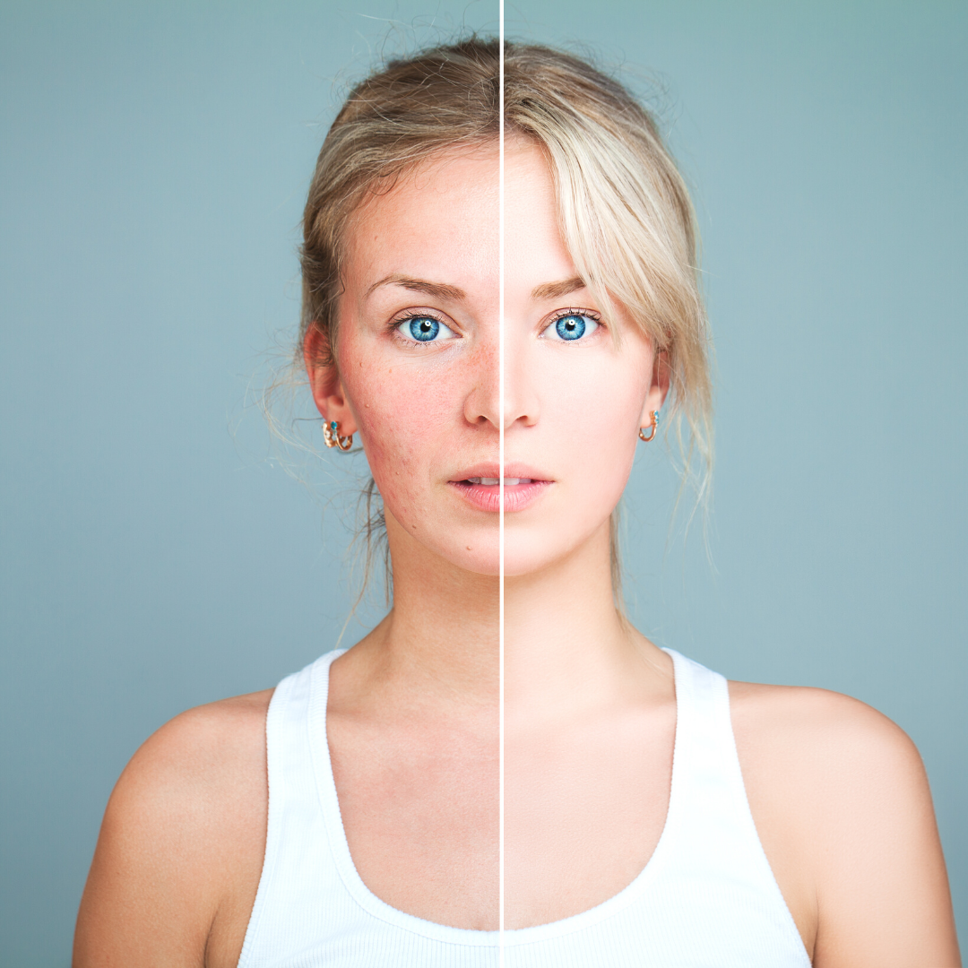 Transition your skin from winter to spring..