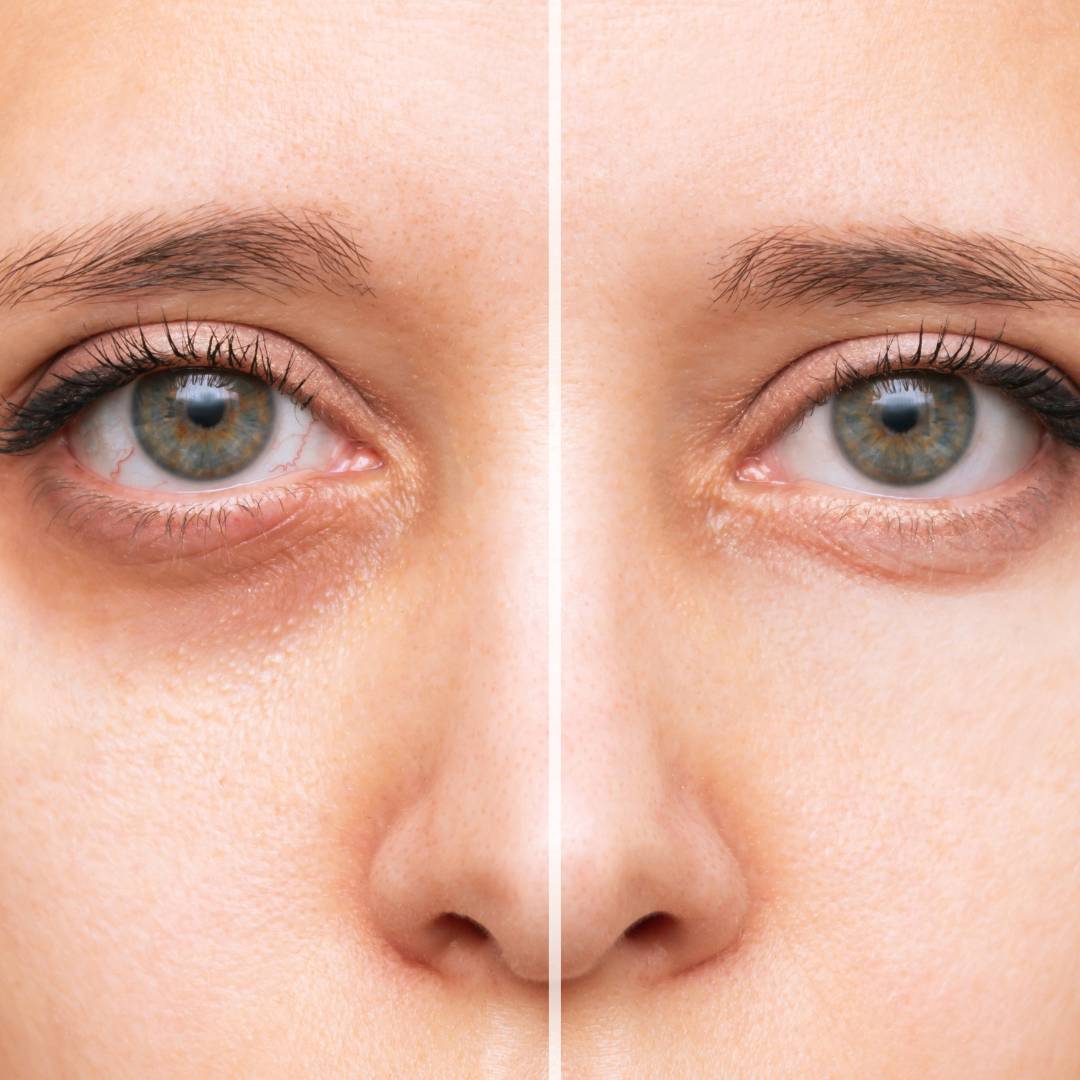 Under Eye Color Corrector Concealer Dark Circles Taylor Made